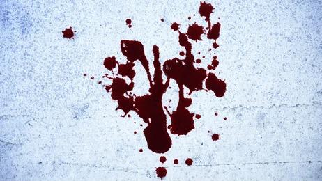  Homem é baleado após atacar equipe da Guarda com uma faca